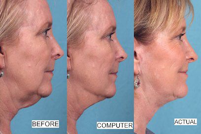 Learn about facial imaging at Primera Plastic Surgery