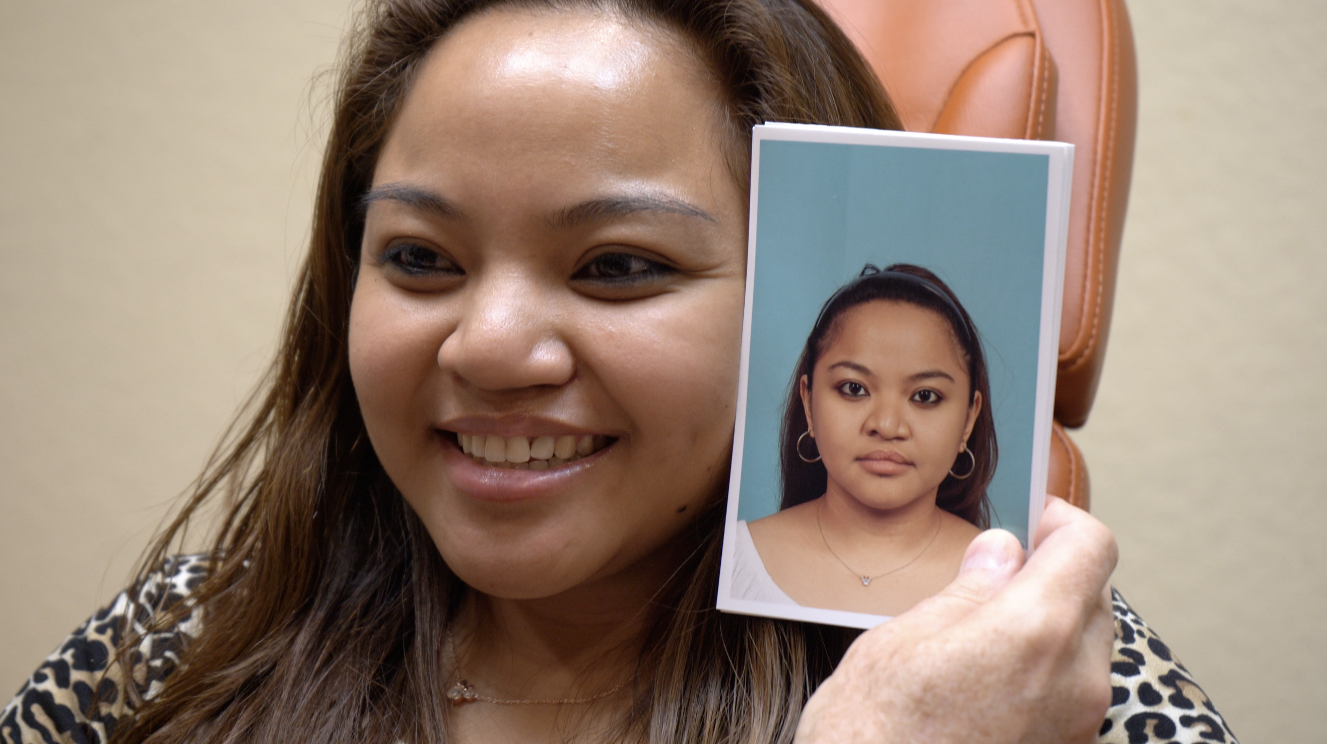 Kirsten, actual rhinoplasty patient, smiling as Dr. Gross holds before photo next to her face