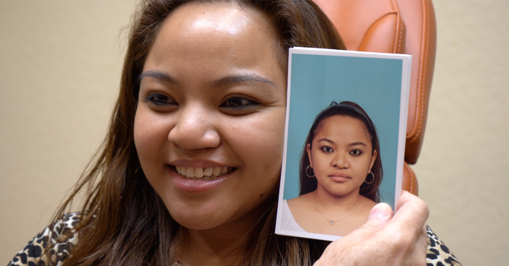 Actual cleft lip adult patient Kirsten smiling with before photo being held next to face.