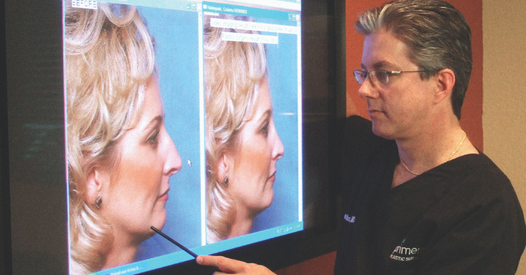 Dr. Gross using Computer Imaging for assessing rhinoplasty in Orlando, FL