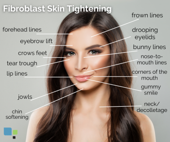 Fibroblast Lift Therapy for Orlando, Winter Park & Tampa, FL – Primera