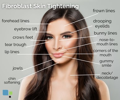 FibroBlast skin tightening graphic