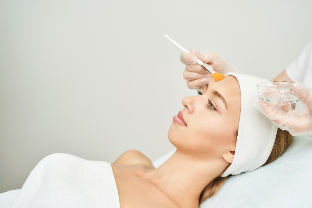 what is a chemical peel