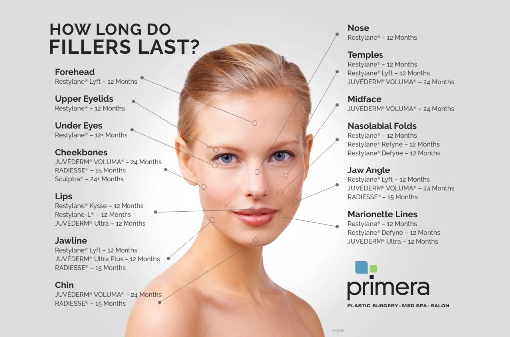 How long do fillers last