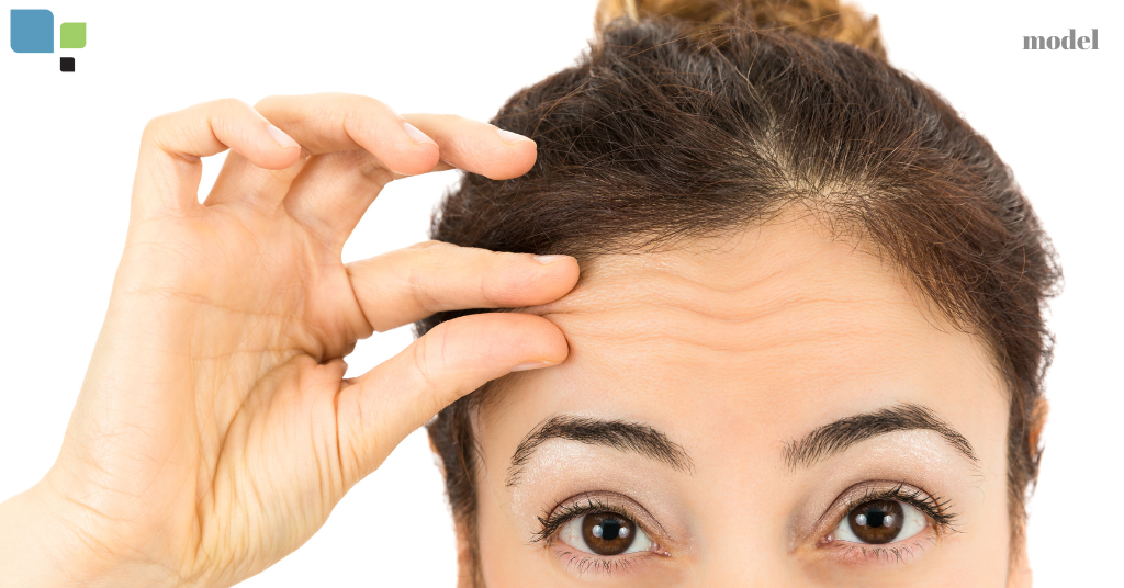 woman holding her forehead wrinkles (model)