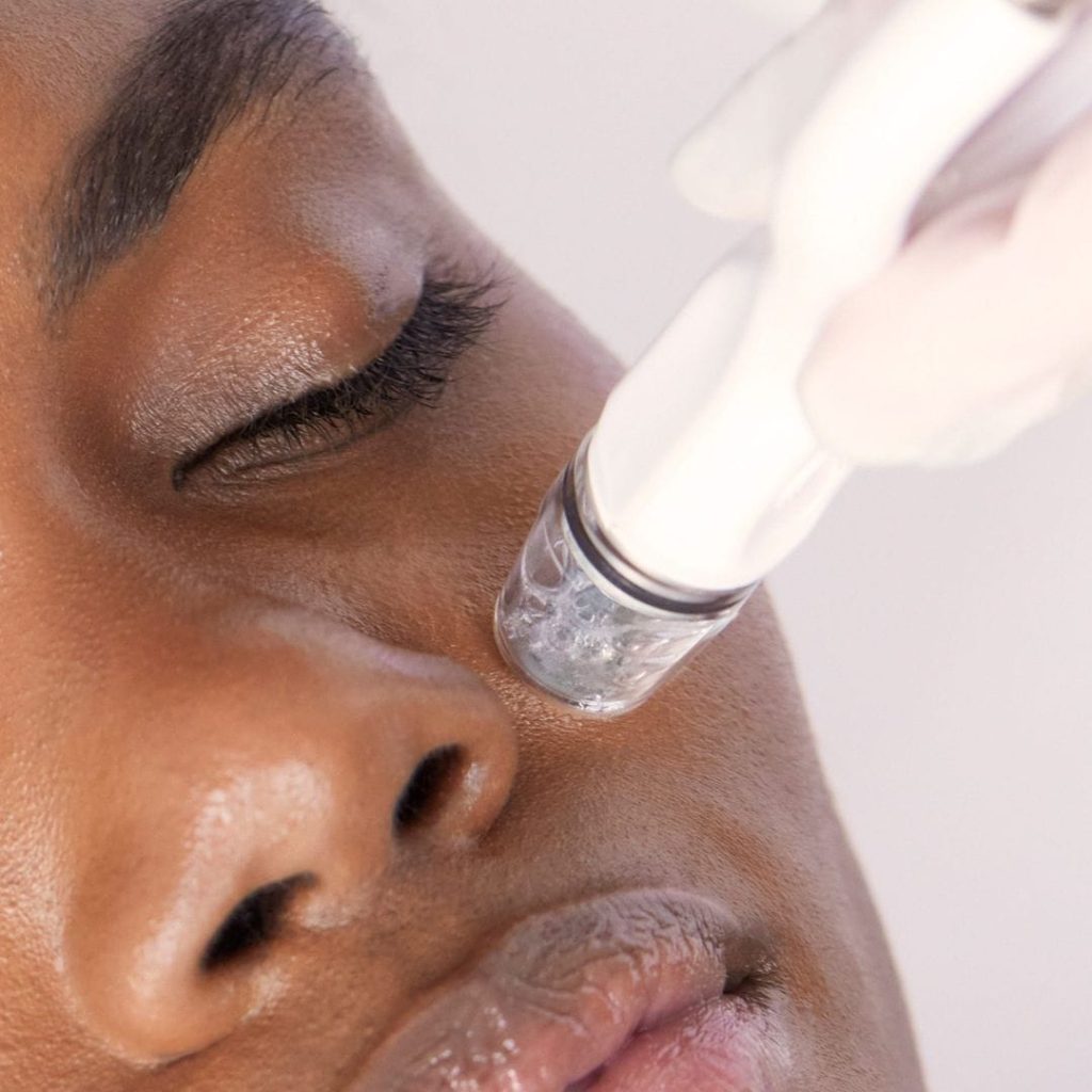 Woman receiving DiamondGlow treatment