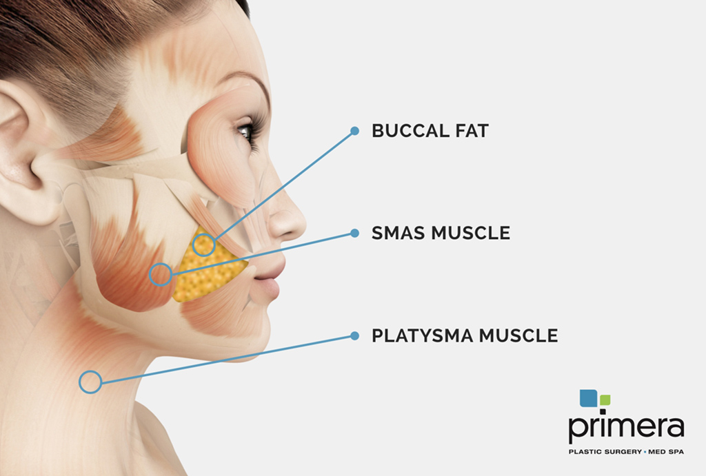 A diagram illustrating the steps involved in a facelift procedure. The diagram shows incisions being made around the ear and hairline, followed by the lifting and repositioning of the facial tissues and muscles. The excess skin is then trimmed, and the incisions are closed with sutures.