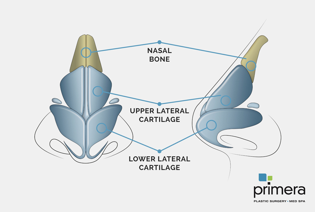A diagram illustrating the steps involved in a rhinoplasty, or nose job, procedure. The diagram shows incisions being made inside the nostrils or on the columella, followed by the reshaping of the nasal bones and cartilage. The skin is then re-draped over the new framework, and the incisions are closed with sutures.