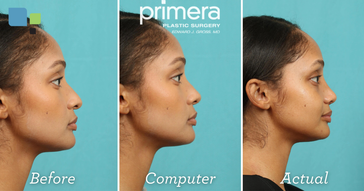 Benefits of Digital Imaging for Plastic Surgery