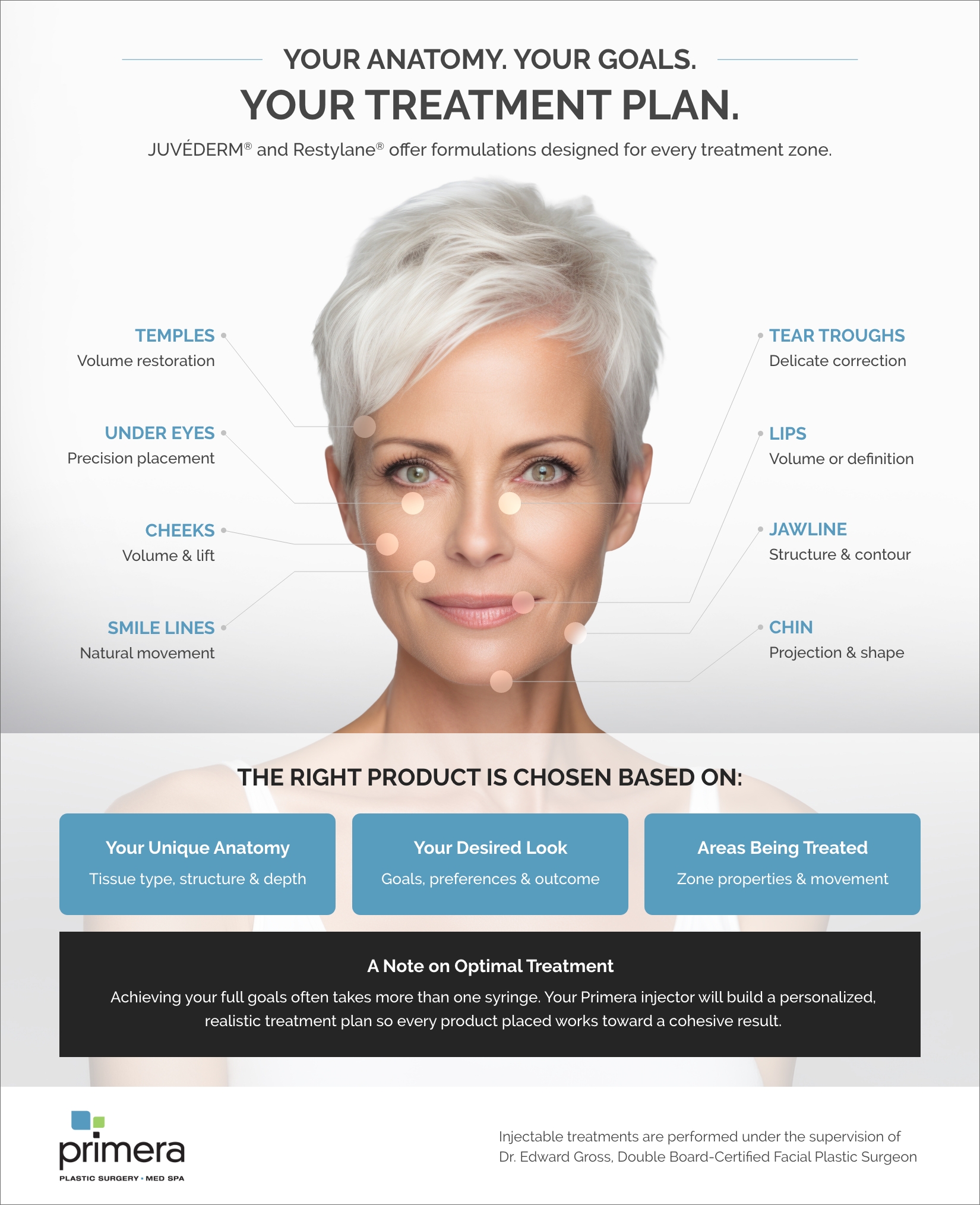Infographic showing a mature woman’s face with labeled facial treatment areas for dermal fillers, including temples, under eyes, cheeks, smile lines, tear troughs, lips, chin, and jawline. The graphic explains that JUVÉDERM® and Restylane® formulations are selected based on a patient’s unique anatomy, desired aesthetic goals, and treatment areas, with a personalized treatment plan developed to achieve cohesive facial rejuvenation results.